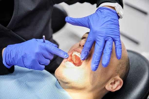 Best Emergency Wisdom Teeth Removal in Lexington, MI